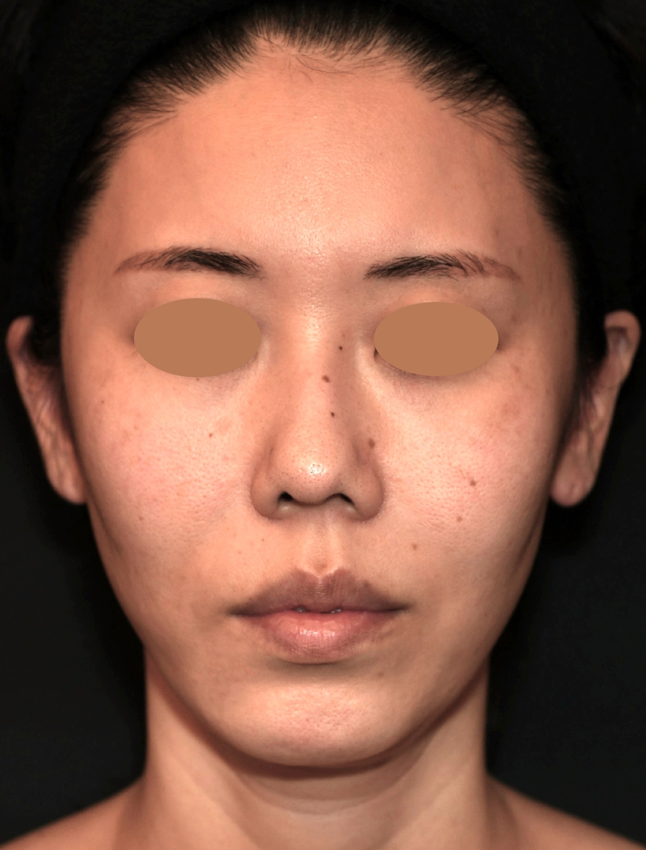 After（アフター）