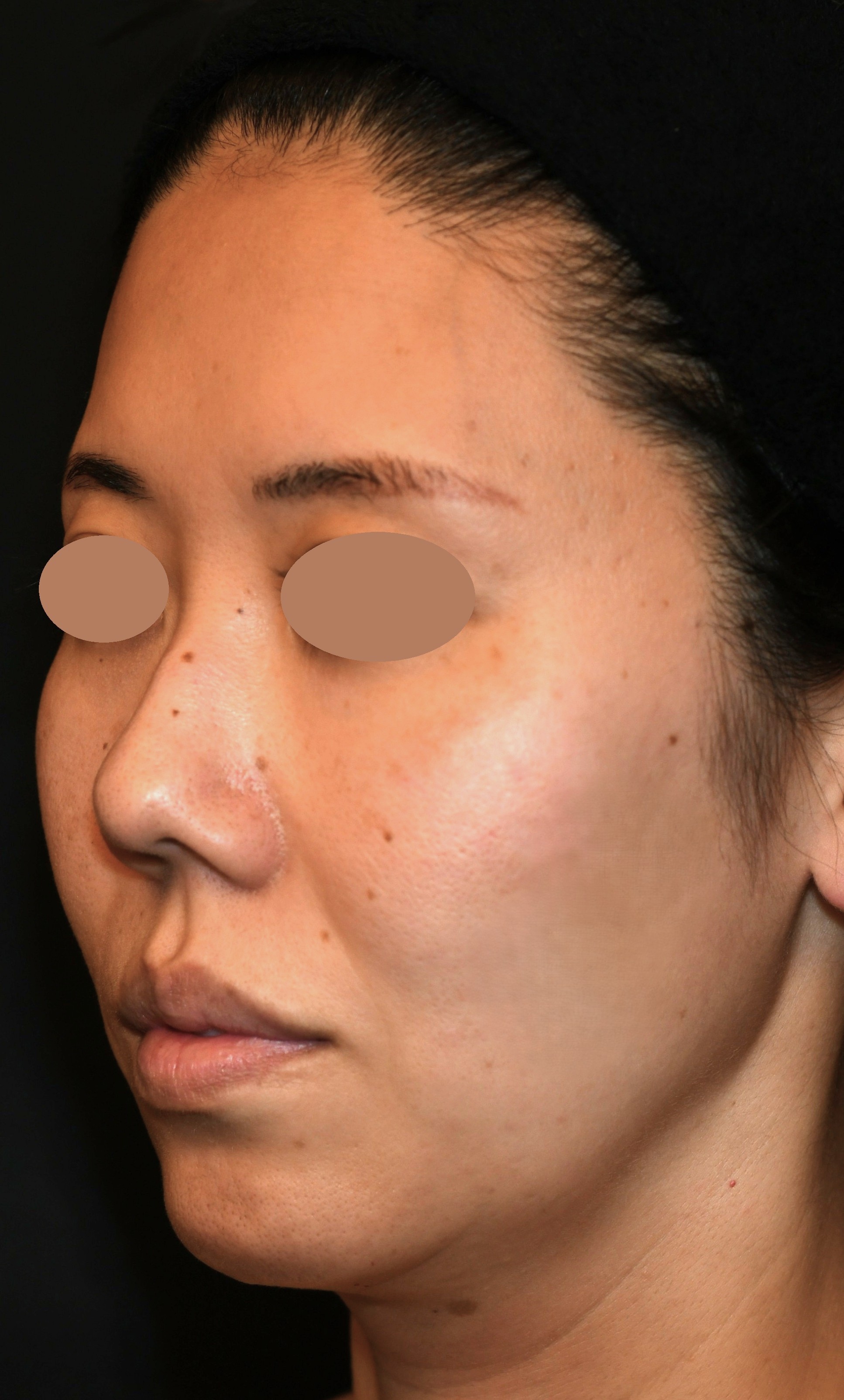 After（アフター）