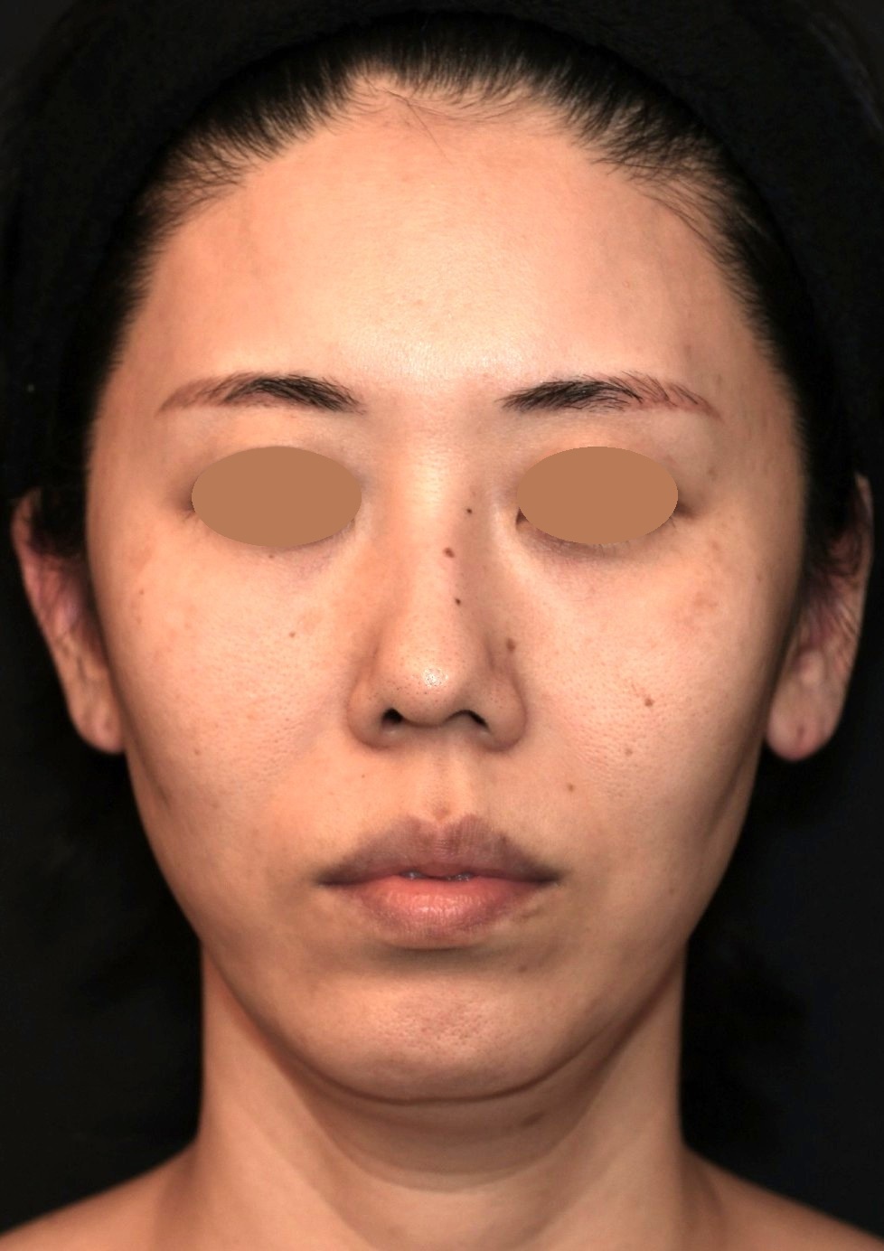 Before（ビフォー）