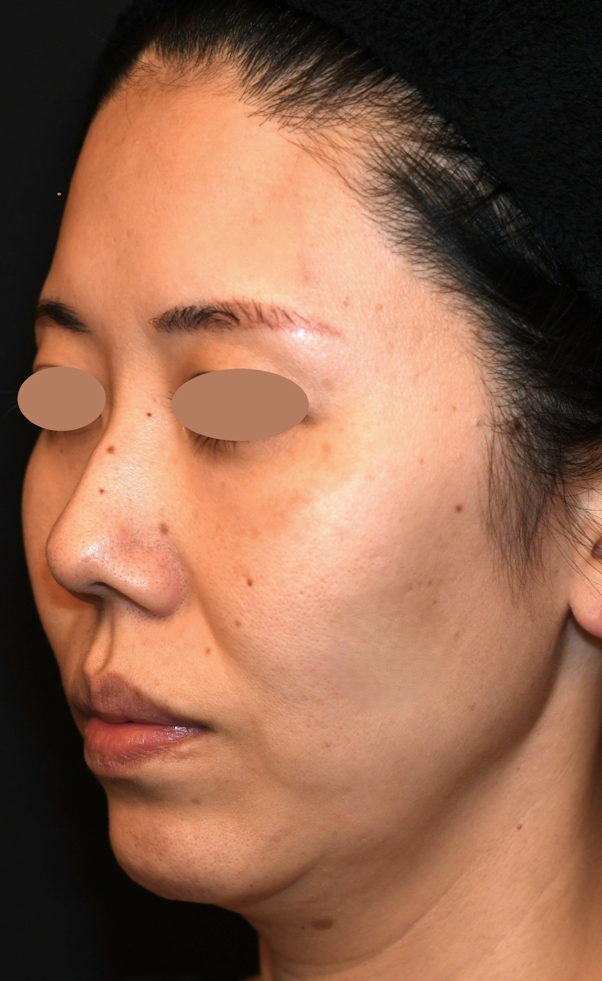 Before（ビフォー）