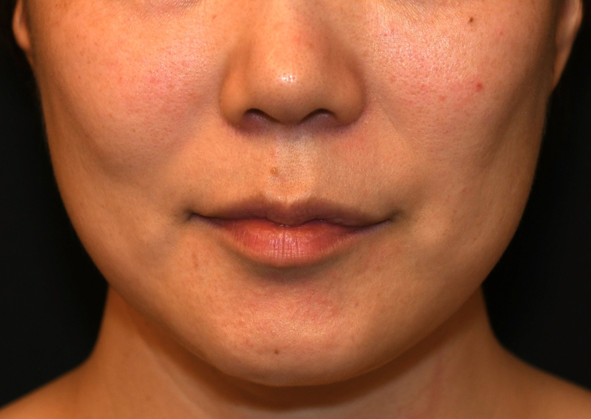 After（アフター）