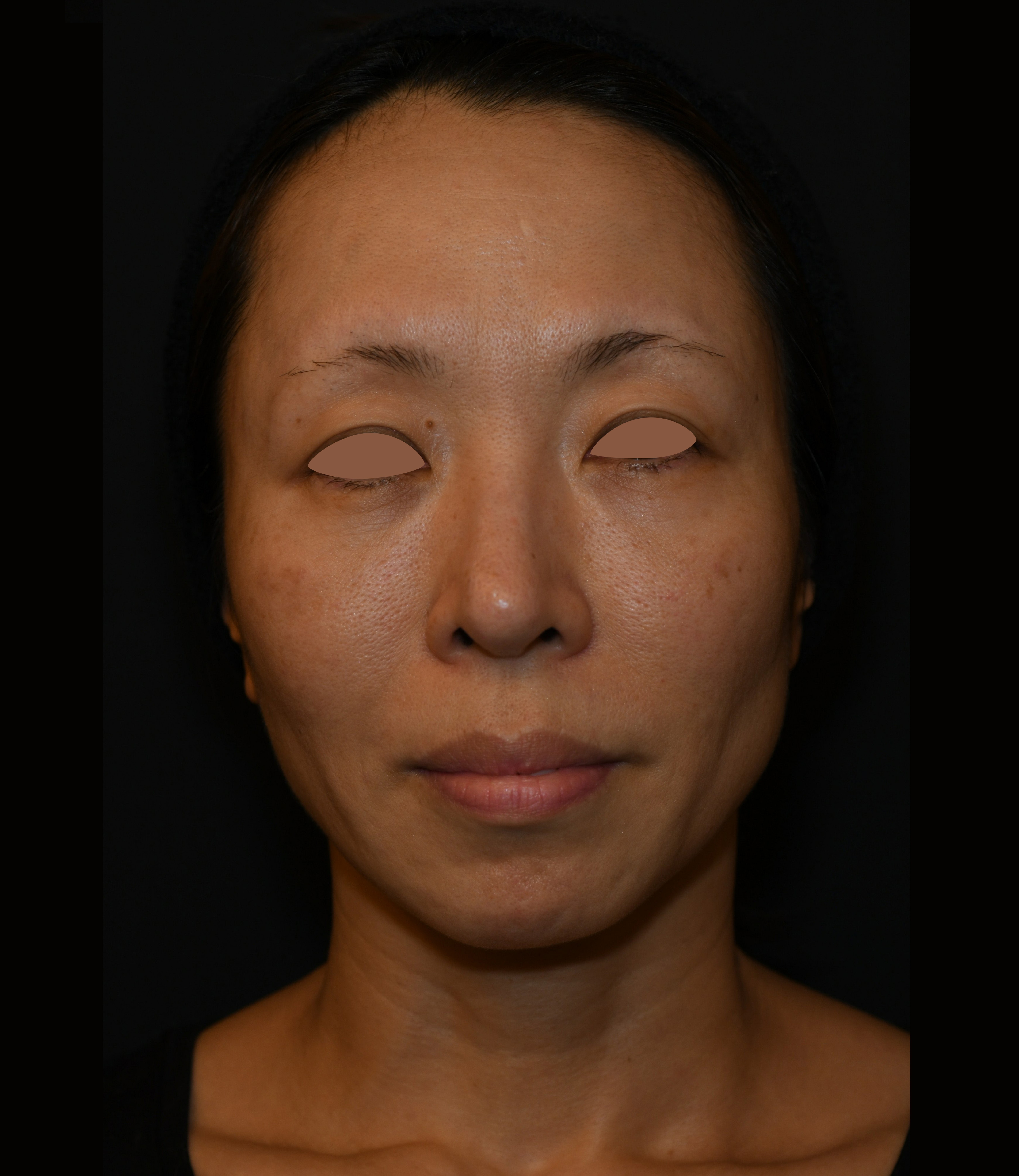 After（アフター）