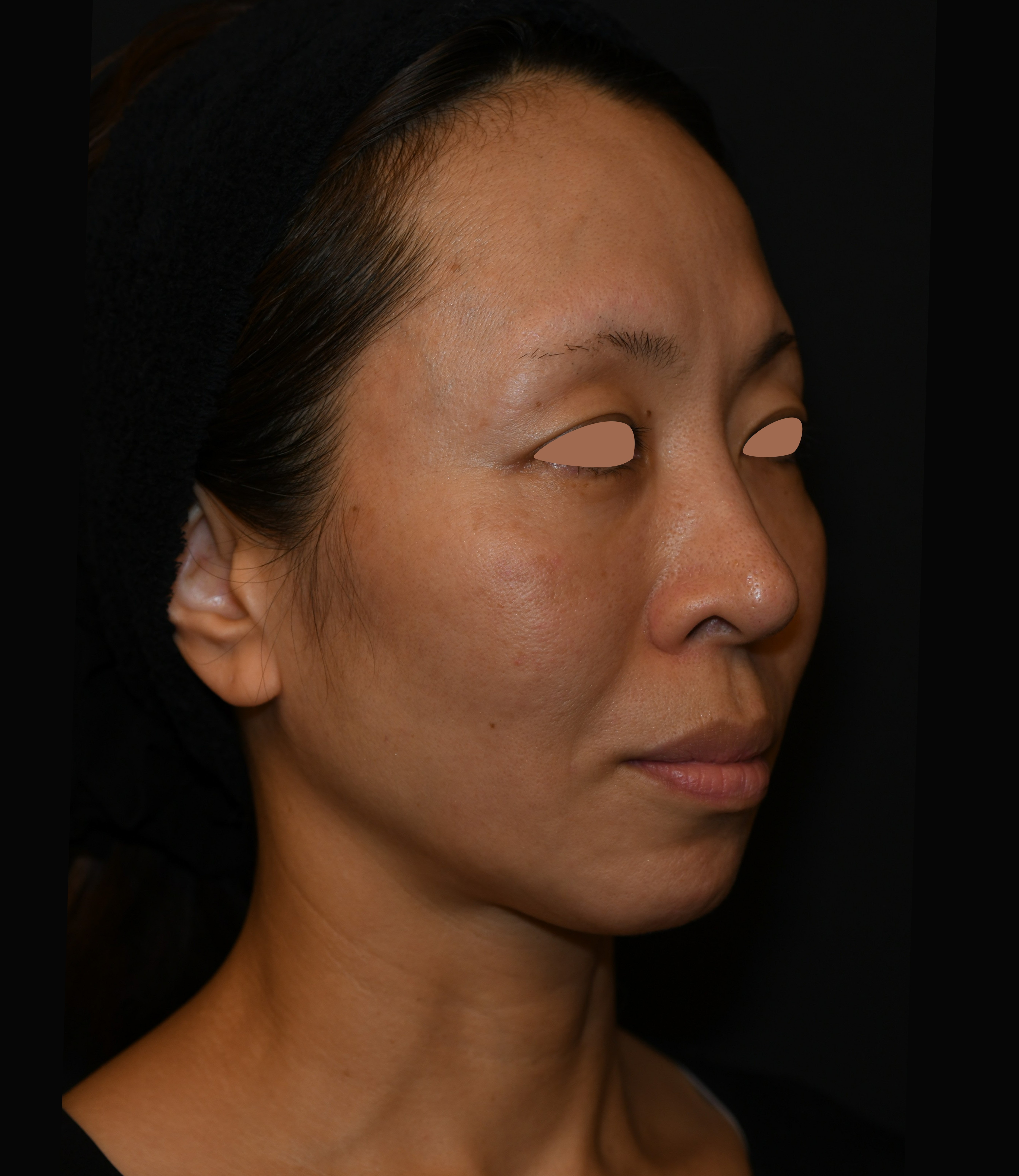 After（アフター）