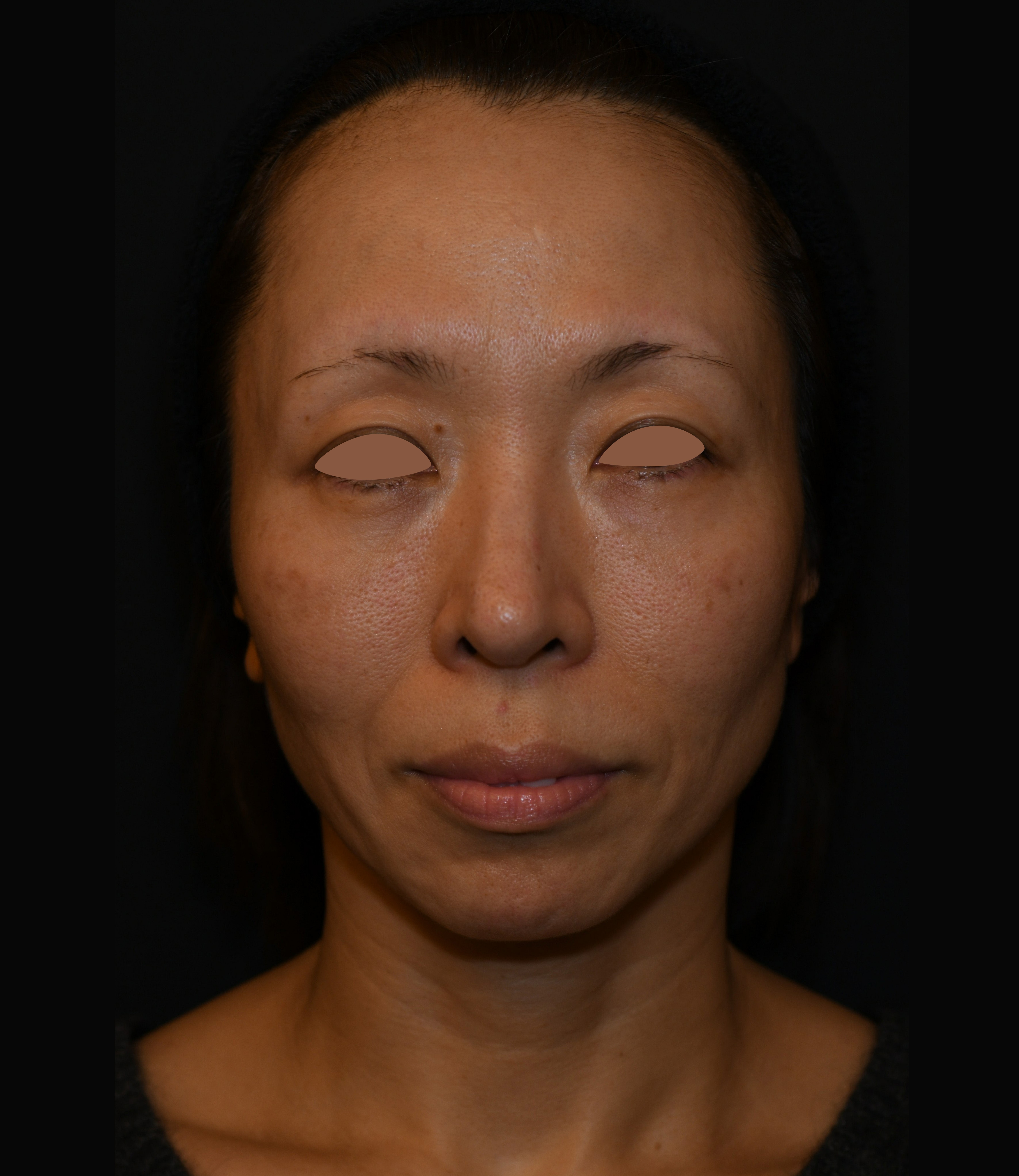 Before（ビフォー）