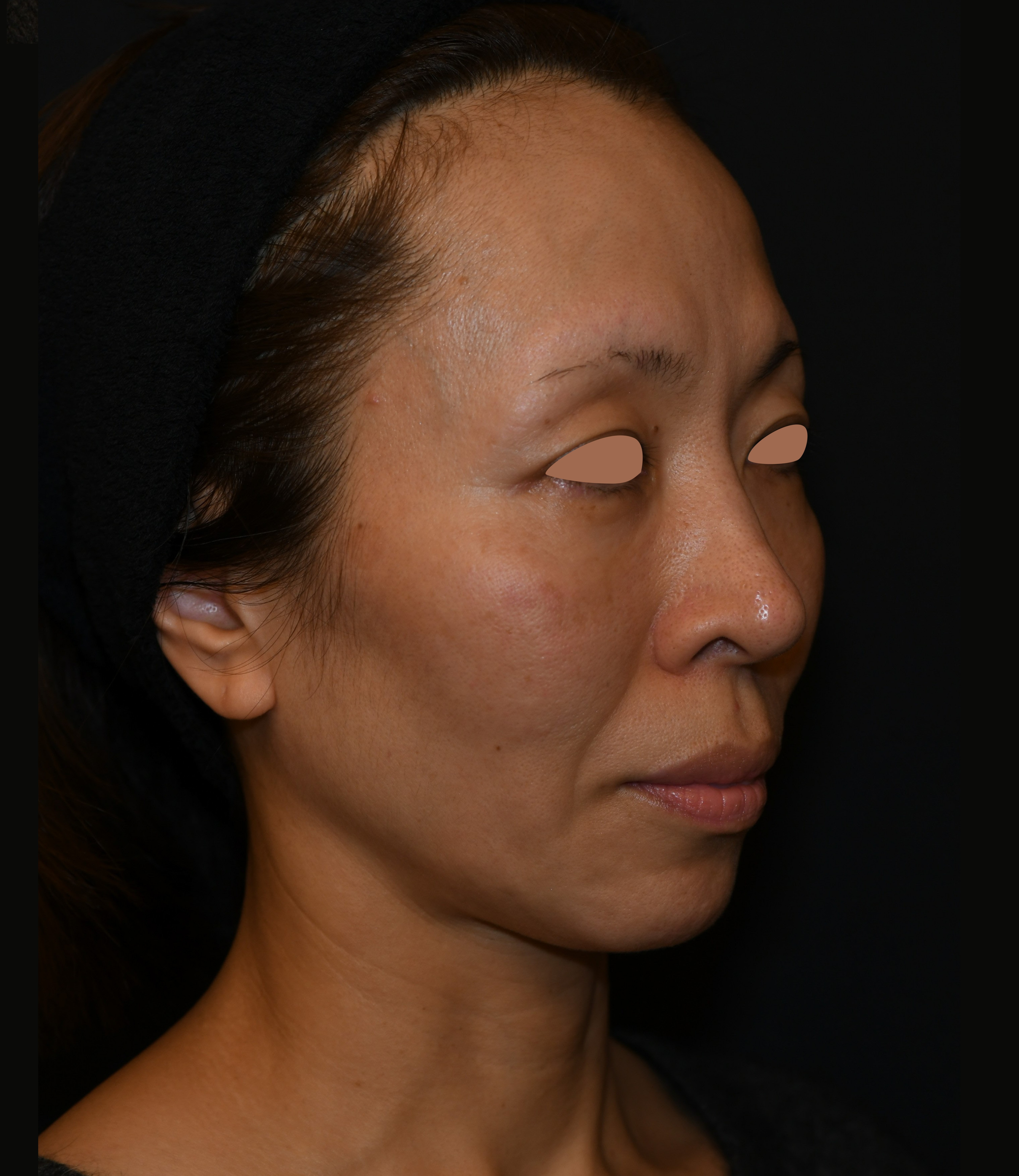 Before（ビフォー）