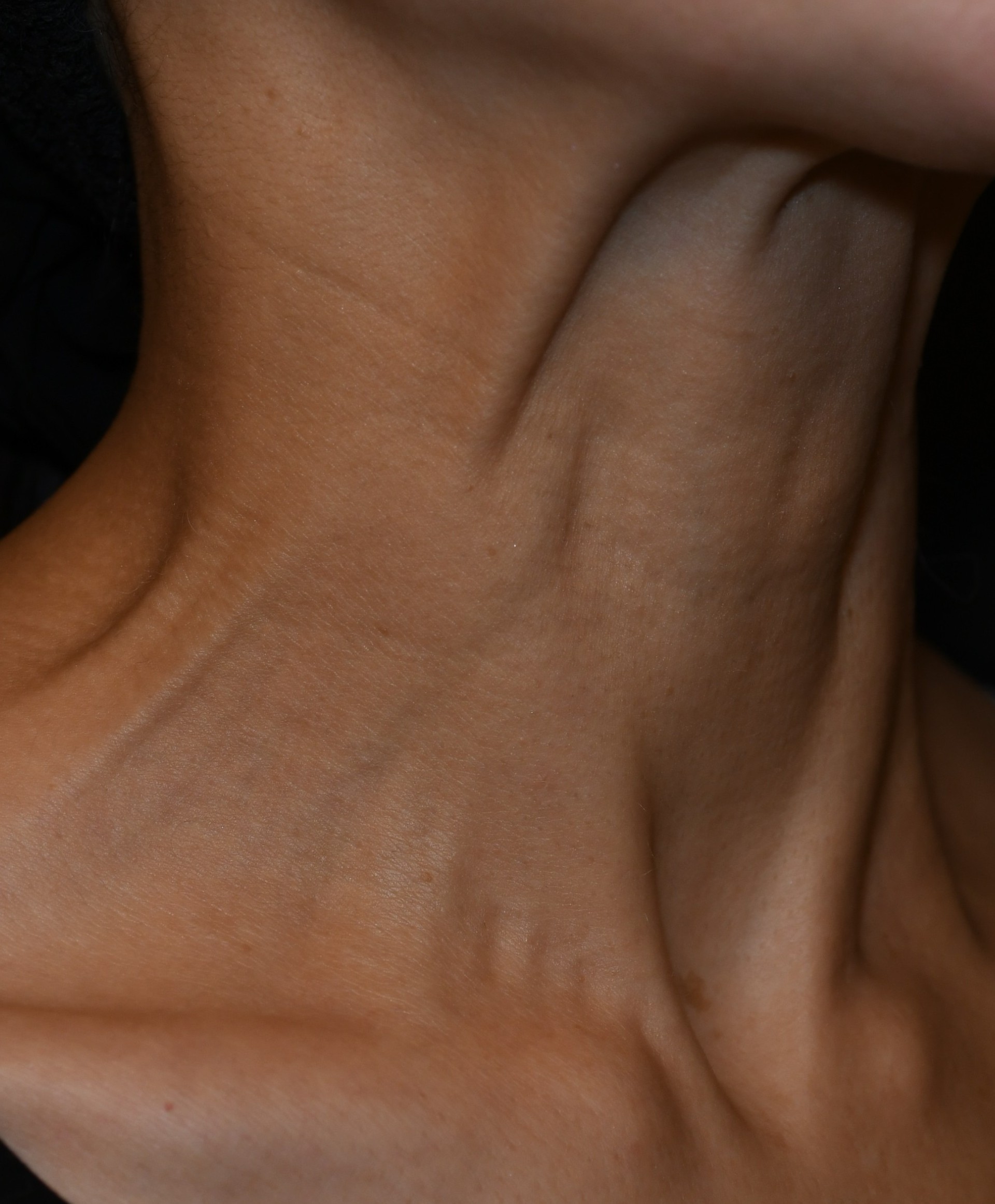 After（アフター）