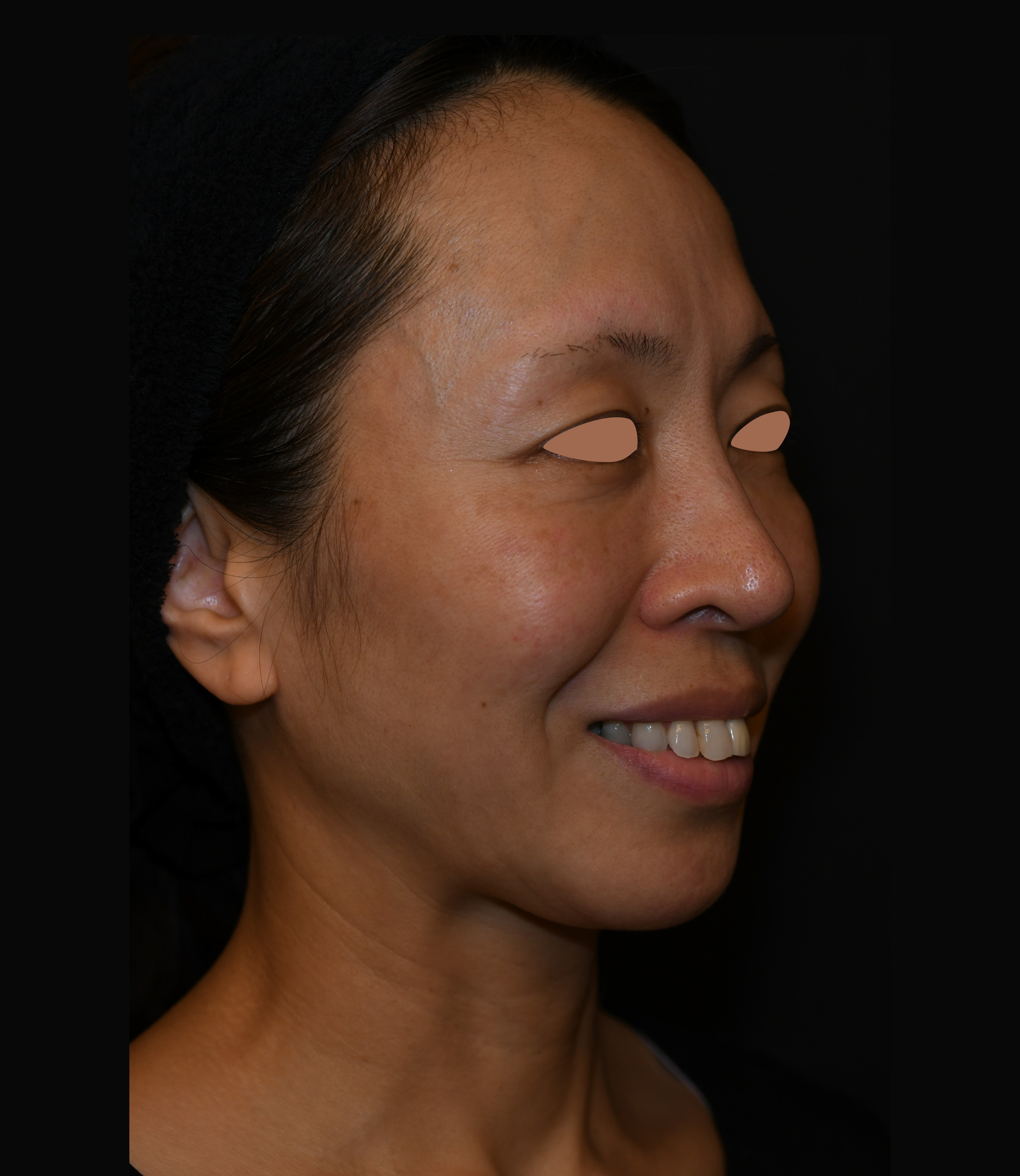 After（アフター）