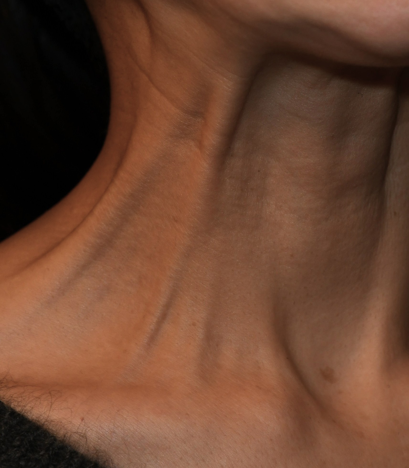 Before（ビフォー）