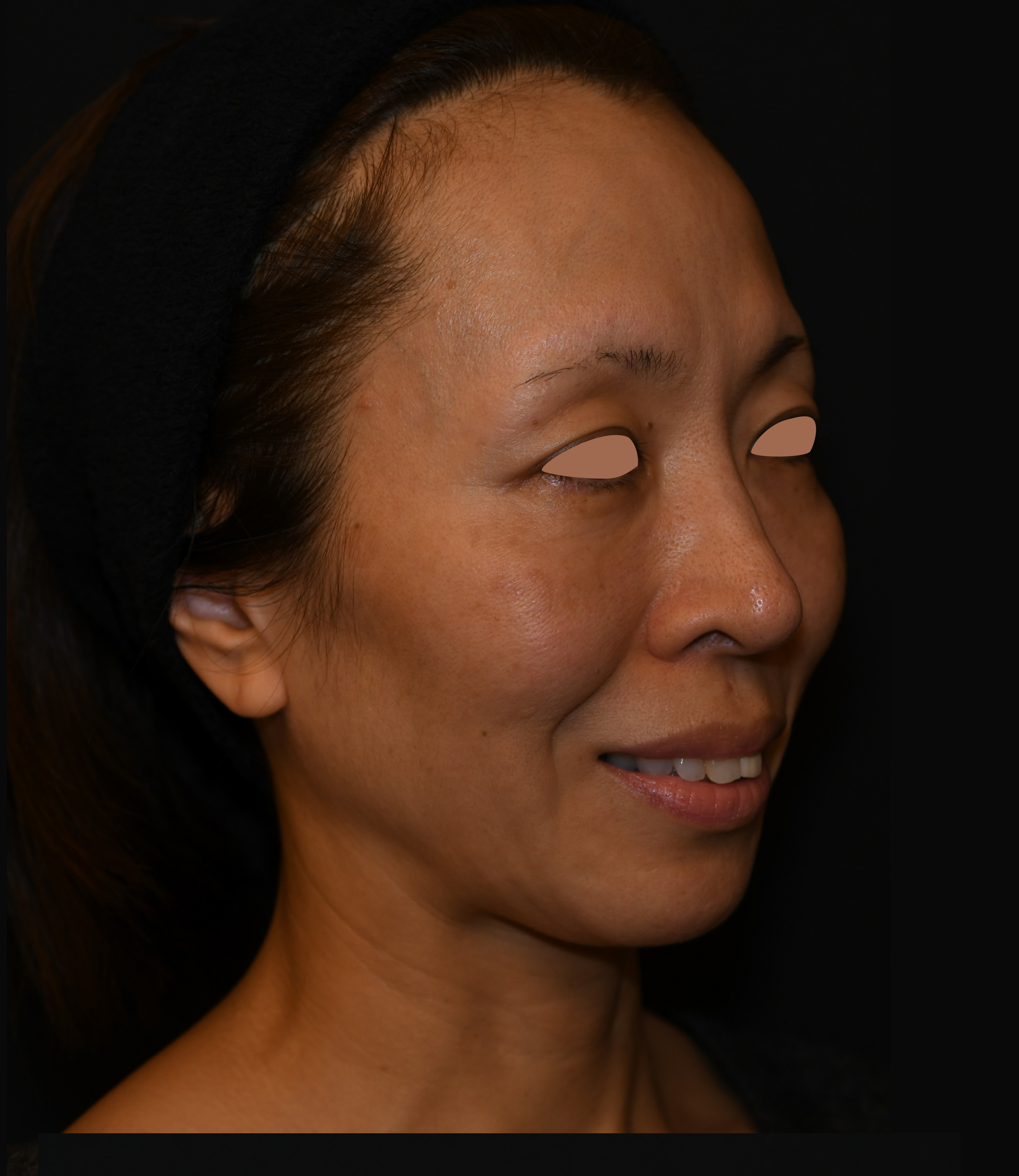 Before（ビフォー）