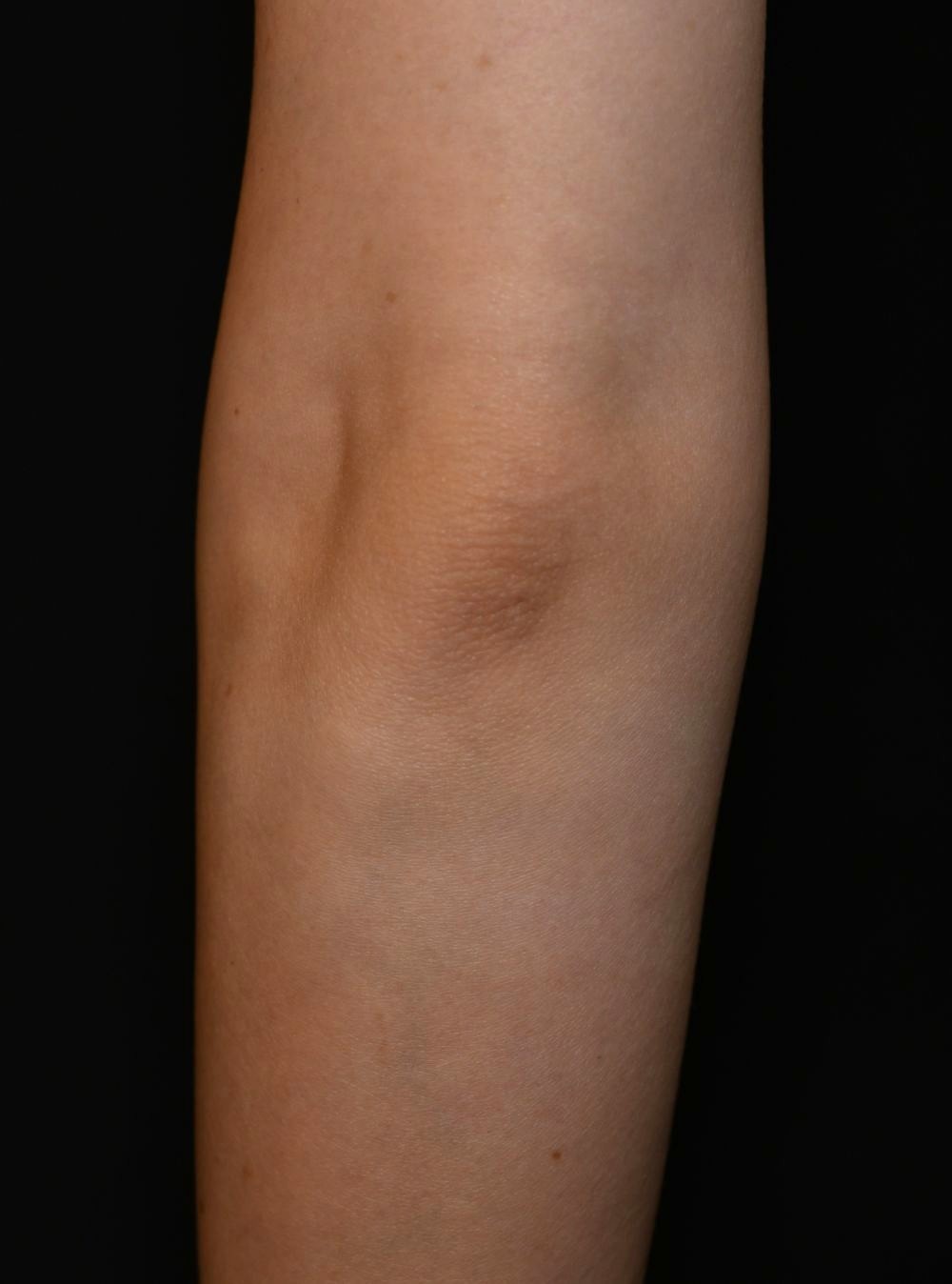 After（アフター）