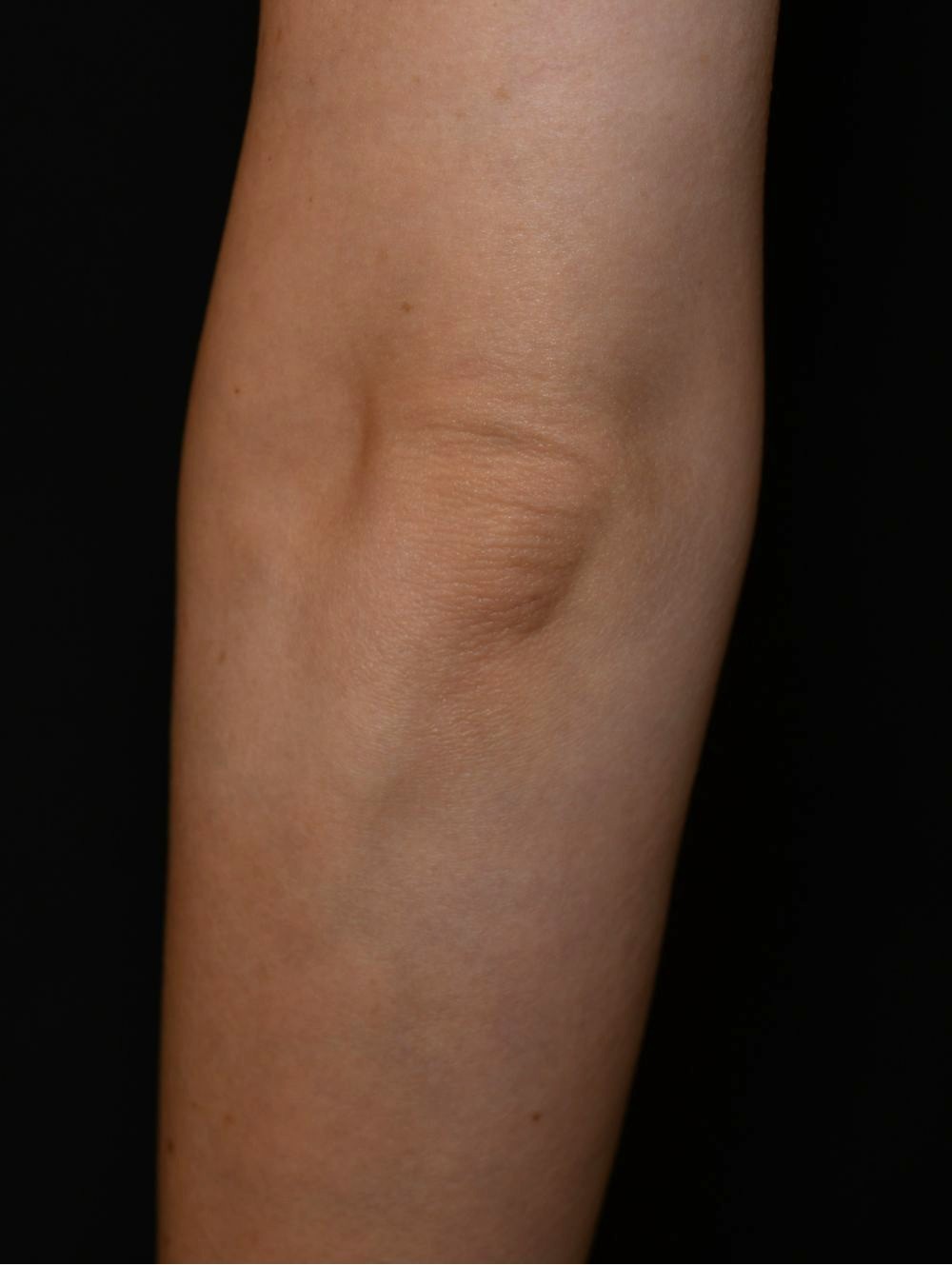 Before（ビフォー）