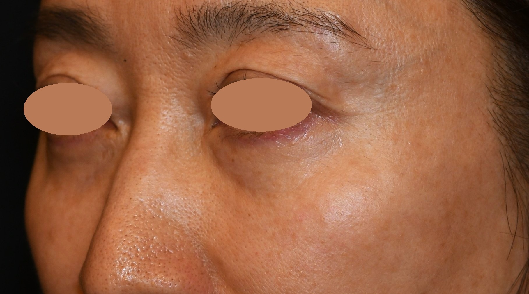 Before（ビフォー）