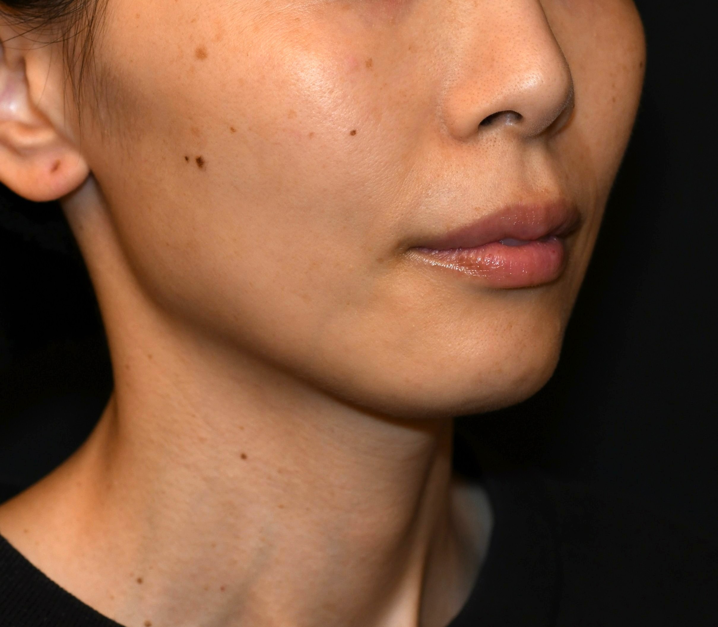 After（アフター）