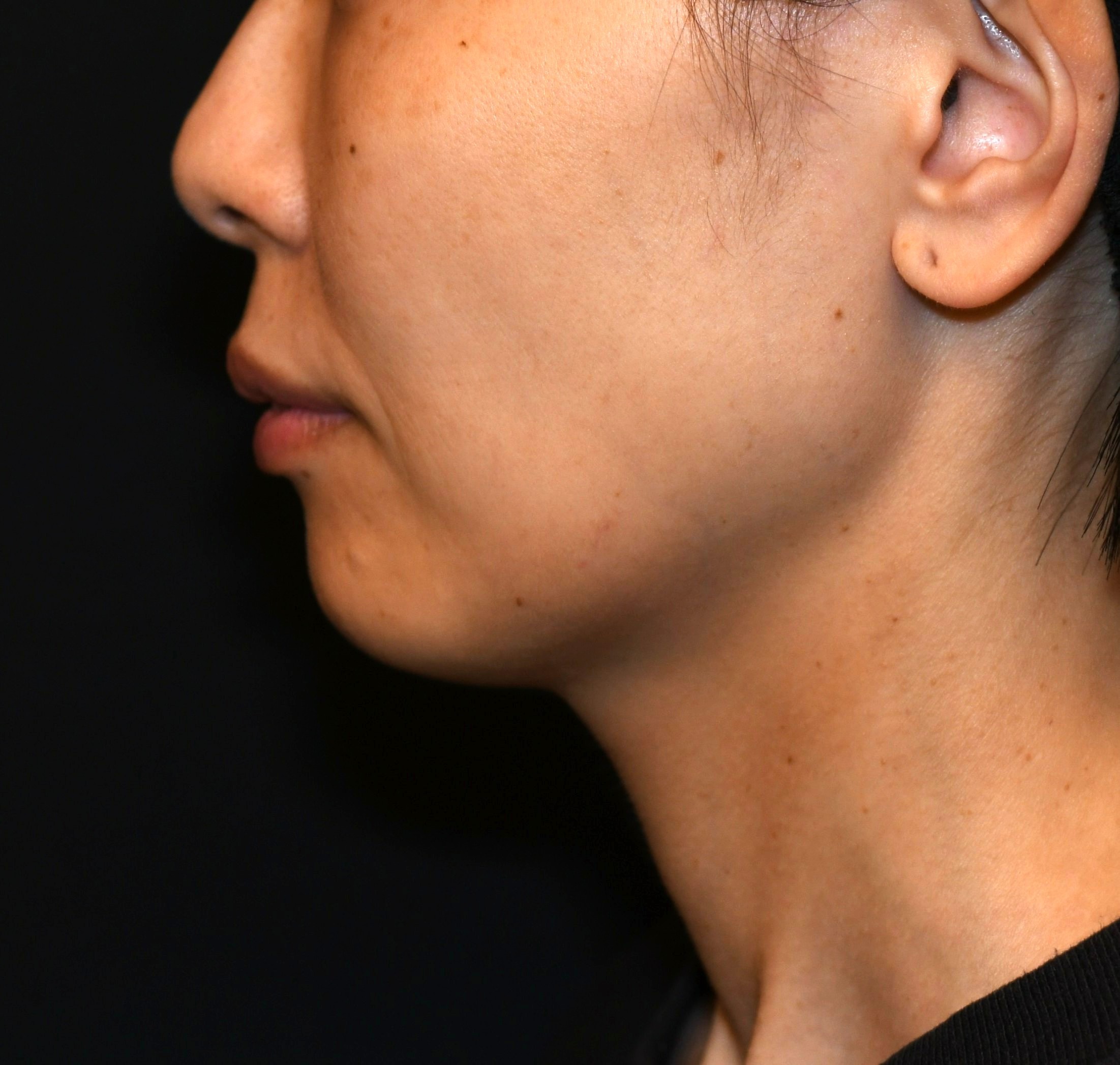 After（アフター）