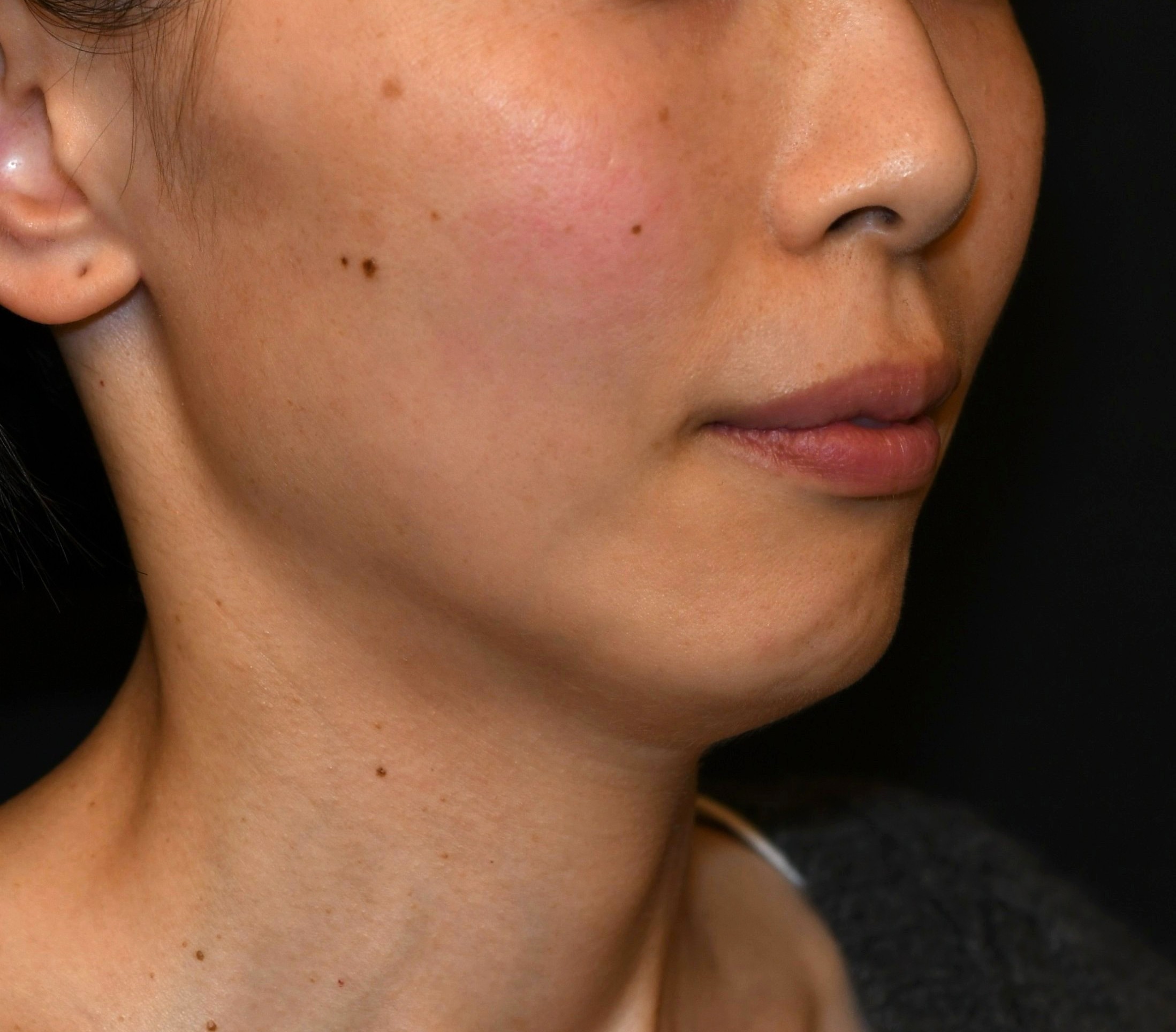 Before（ビフォー）