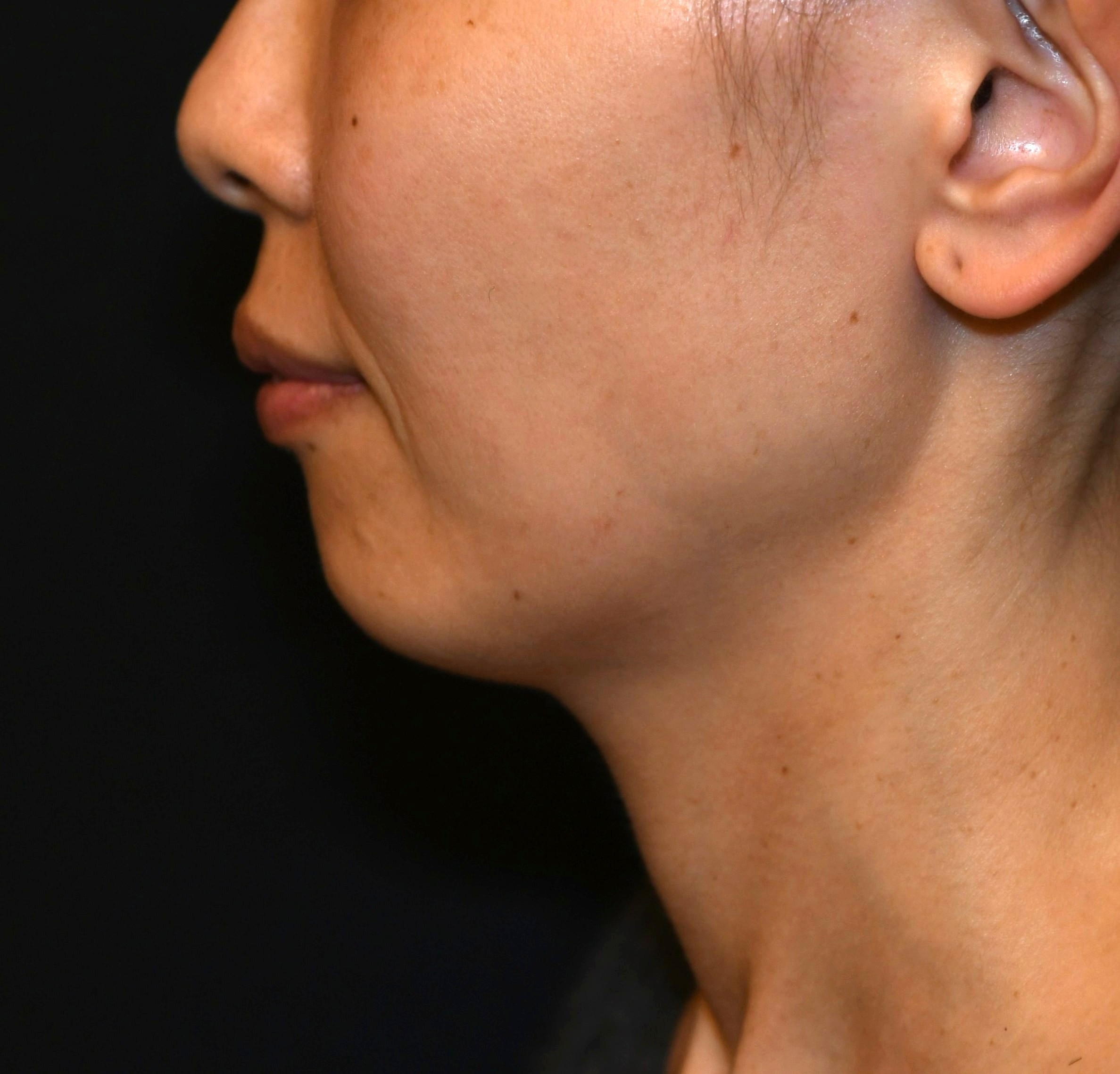 Before（ビフォー）