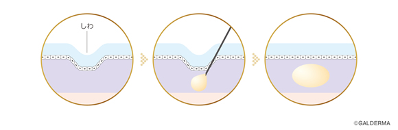 vista-shape_img_09.png.jpg